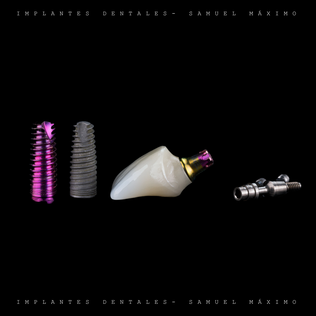 Implantes Dentales