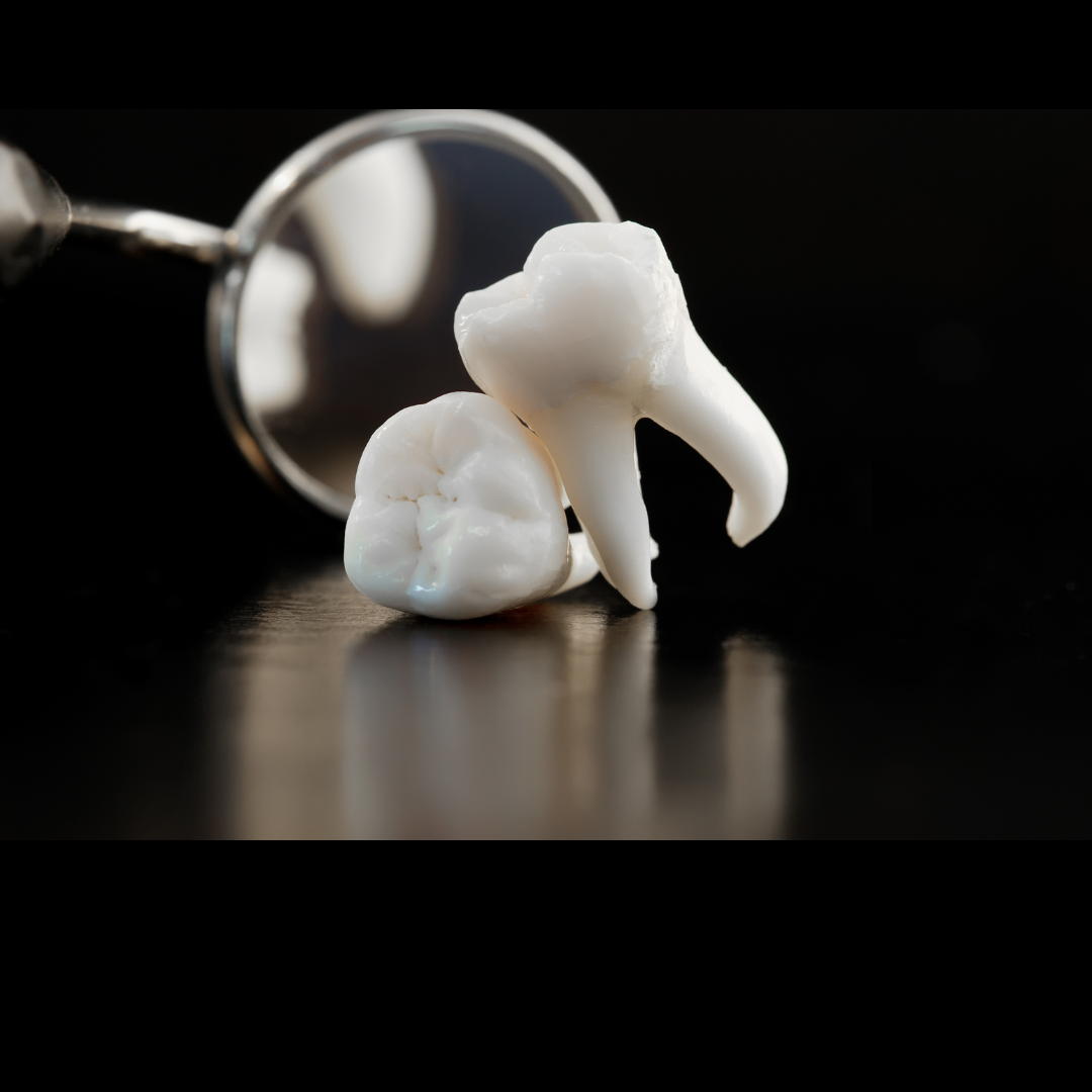 Extracciones Dentales