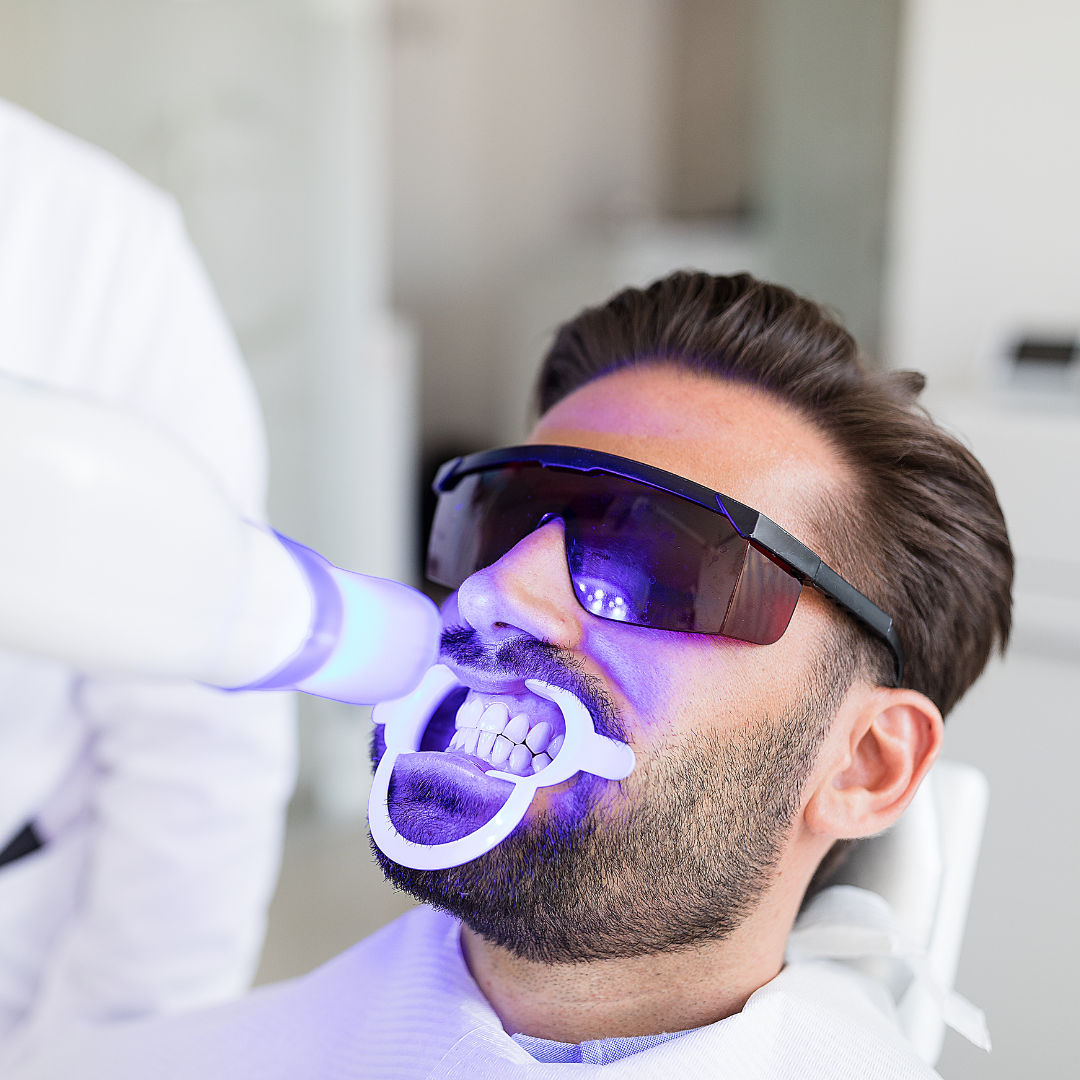 Blanqueamiento Dental